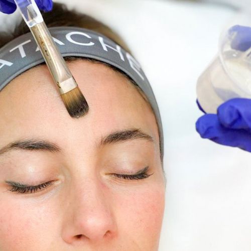 Sabadell peelings facials